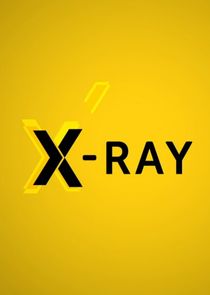 X-Ray Ne Zaman?'