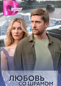 Любовь со шрамом Ne Zaman?'